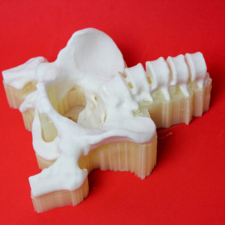 BCN3D Pelvis 2